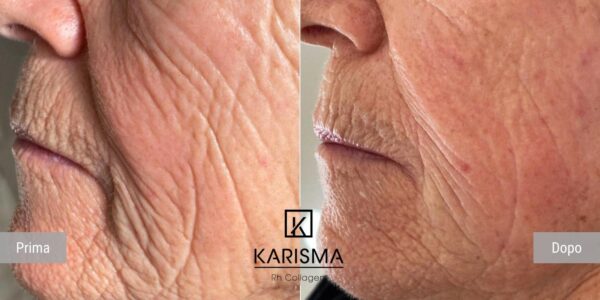 KARISMA RH COLLAGEN 14th September 2025