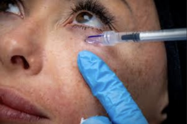 The New Skin Rejuvenation Approach