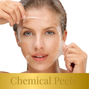 Chemical Peels Training 25th of July